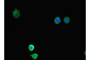Immunofluorescent analysis of MCF-7 cells using ABIN7158695 at dilution of 1:100 and Alexa Fluor 488-congugated AffiniPure Goat Anti-Rabbit IgG(H+L) (KDM4A antibody  (AA 127-364))