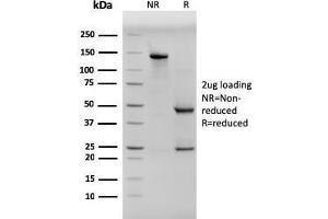 SDS-PAGE Analysis Purified Pan-Cytokeratin Mouse Monoclonal Antibody (PCK/3150). (KRT antibody)