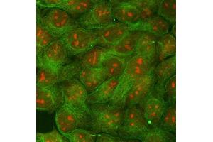 IF analysis of RRP1B and Tubulin beta using anti-RRP1B antibody (ABIN7600561) and anti-Tubulin beta antibody (ABIN7602744). (RRP1B antibody  (AA 20-727))