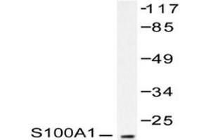 Image no. 2 for anti-S100 Calcium Binding Protein A1 (S100A1) antibody (ABIN271809) (S100A1 antibody)