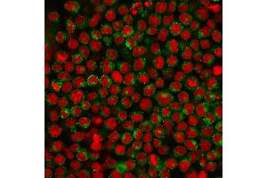 Immunofluorescence (IF) image for anti-CD27 Molecule (CD27) antibody (ABIN6941124)