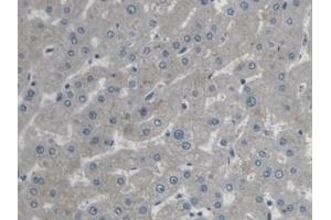 Detection of STIM1 in Human Liver Tissue using Polyclonal Antibody to Stromal Interaction Molecule 1 (STIM1) (STIM1 antibody  (AA 1-211))