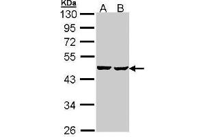 WB Image Sample (30 ug of whole cell lysate) A: Hep G2 , B: Molt-4 , 10% SDS PAGE antibody diluted at 1:1000 (SUCLA2 antibody)
