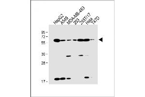 All lanes : Anti-SLC47A1 Antibody (C-term) at 1:2000 dilution Lane 1: HepG2 whole cell lysate Lane 2: A549 whole cell lysate Lane 3: MDA-MB-453 whole cell lysate Lane 4: 293 whole cell lysate Lane 5: 293T/17 whole cell lysate Lane 6: Hela whole cell lysate Lane 7: T47D whole cell lysate Lysates/proteins at 20 μg per lane.