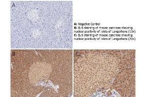 Immunohistochemistry with anti-IL-6 antibody showing nuclear positivity of islets of Langerhans (brown staining) and cytoplasmic staining in mouse pancreas at 10x and 20x (B & C). (IL-6 antibody)