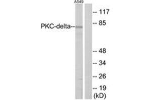 Western blot analysis of extracts from A549 cells, treated with TNF-alpha 20ng/ml 30', using HSF1 (Ab-303) Antibody. (HSF1 antibody  (AA 270-319))