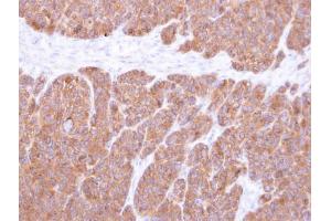 IHC-P Image Immunohistochemical analysis of paraffin-embedded SW480 xenograft, using VTA1, antibody at 1:500 dilution. (VTA1 antibody  (Center))