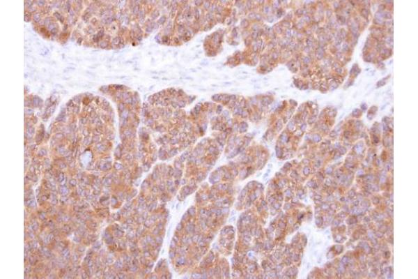 VTA1 antibody  (Center)