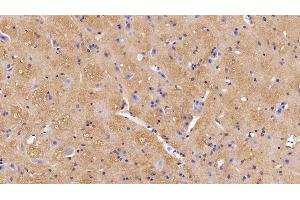 Detection of MOG in Mouse Spinal cord Tissue using Polyclonal Antibody to Myelin Oligodendrocyte Glycoprotein (MOG) (MOG antibody  (AA 30-149))