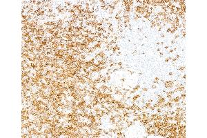 Immunohistochemistry (IHC) image for anti-Biotin antibody (ABIN7795728) (Recombinant Biotin antibody)