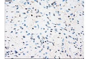 Immunohistochemical staining of paraffin-embedded Ovary tissue using anti-ZFP36 mouse monoclonal antibody. (ZFP36 antibody)