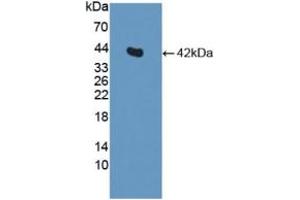 WB of Protein Standard: different control antibodies against Highly purified E. (Insulin ELISA Kit)