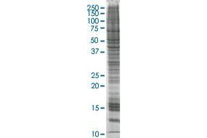 AKR1C2 transfected lysate (AKR1C2 HEK293 Cell Transient Overexpression Lysate(Non-Denatured))