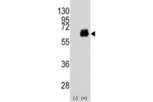Western blot analysis of Myc antibody and 293 cell lysate (2 ug/lane) either nontransfected (Lane 1) or transiently transfected with the MYC gene (2). (c-MYC antibody  (AA 36-65))