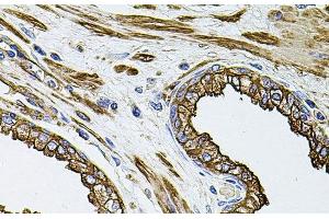 Immunohistochemistry of paraffin-embedded Human prostate using FLNB Polyclonal Antibody at dilution of 1:100 (40x lens). (FLNB antibody)