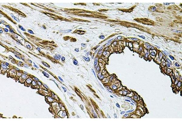 FLNB antibody