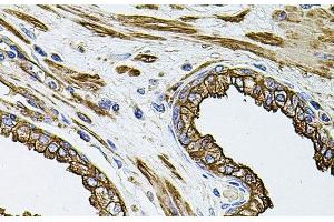 Immunohistochemistry of paraffin-embedded Human prostate using FLNB Polyclonal Antibody at dilution of 1:100 (40x lens).