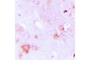 Immunohistochemical analysis of ALDOC staining in human brain formalin fixed paraffin embedded tissue section. (ALDOC antibody  (Center))