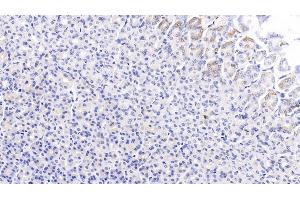Immunohistochemistry (IHC) image for anti-Proprotein Convertase Subtilisin/kexin Type 9 (PCSK9) (AA 164-428) antibody (ABIN7427117)