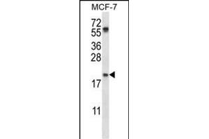 PYCARD Antibody (C-term) (ABIN657783 and ABIN2846757) western blot analysis in MCF-7 cell line lysates (35 μg/lane).