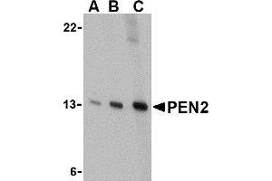 Western Blotting (WB) image for anti-Presenilin Enhancer 2 Homolog (PSENEN) (C-Term) antibody (ABIN1030574) (PEN2 antibody  (C-Term))