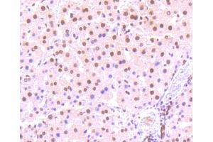 Paraformaldehyde-fixed, paraffin embedded rat liver, Antigen retrieval by boiling in sodium citrate buffer (pH6) for 15min, Block endogenous peroxidase by 3% hydrogen peroxide for 30 minutes, Blocking buffer at 37°C for 20min, Antibody incubation with STAT3(S727) (4G1) Monoclonal Antibody  at 1:50 overnight at 4°C, followed by a conjugated secondary and DAB staining.