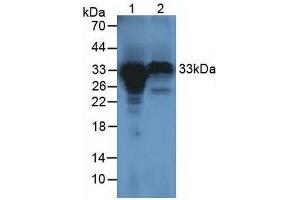 Figure. (HCCS antibody  (AA 1-268))