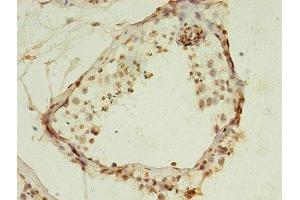 Immunohistochemistry of paraffin-embedded human testis tissue using ABIN7155356 at dilution of 1:100 (HIST1H2AG antibody  (AA 2-130))