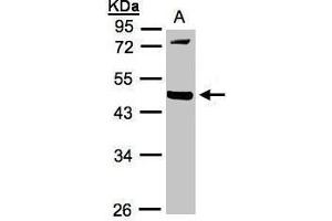 WB Image Sample(30 ug whole cell lysate) A:293T 10% SDS PAGE antibody diluted at 1:1000 (MMP12 antibody)