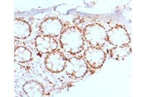 IHC testing of FFPE rat colon with FOXA1 antibody. (FOXA1 antibody  (AA 372-472))