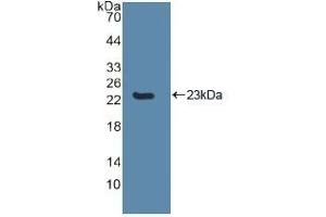 Detection of Recombinant CASP8, Human using Polyclonal Antibody to Caspase 8 (CASP8) (Caspase 8 antibody  (AA 217-384))