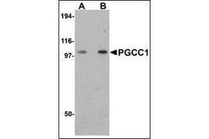 Western blot analysis of PGCC1 in rat thymus tissue lysate with this product at (A) 0.