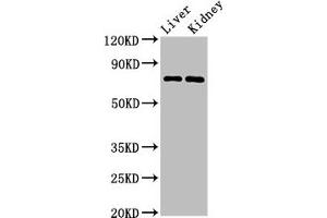 Western Blot Positive WB detected in: Mouse liver tissue, Mouse kidney tissue All lanes: PRDM5 antibody at 3 μg/mL Secondary Goat polyclonal to rabbit IgG at 1/50000 dilution Predicted band size: 74, 70, 13, 59 kDa Observed band size: 74 kDa (PRDM5 antibody  (AA 29-111))