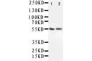 Anti-ALDH1A1 antibody, Western blotting Lane 1: Rat Lung Tissue Lysate Lane 2: COLO320 Cell Lysate (ALDH1A1 antibody  (Middle Region))