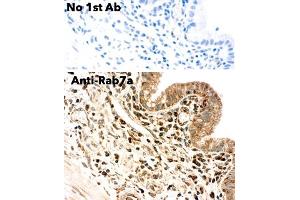 Immunohistochemistry (IHC) image for anti-RAB7A, Member RAS Oncogene Family (RAB7A) (C-Term) antibody (ABIN6254195) (RAB7A antibody  (C-Term))