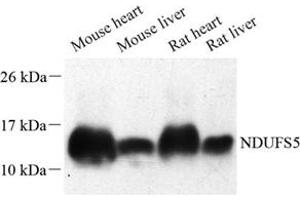 Western blot analysis of NDUFS5 (ABIN7074767) at dilution of 1: 500 (NDUFS5 antibody)