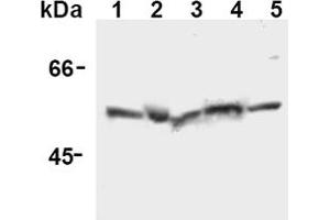 Western Blotting (WB) image for anti-Caspase 12 (Gene/pseudogene) (CASP12) (AA 95-318), (N-Term) antibody (ABIN567796) (Caspase 12 antibody  (N-Term))