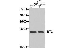 Western blot analysis of extracts of various cell lines, using BTC antibody. (Betacellulin antibody  (AA 32-178))