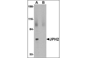 Western blot analysis of JPH2 in 293 cell lysate with this product at 2 μg/ml in (A) the absence and (B) the presence of blocking peptide.