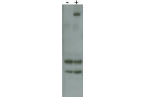 RK8 (LRRK2) Antibody  f detects over-expressed human LRRK2 protein. (LRRK2 antibody  (AA 878-909))