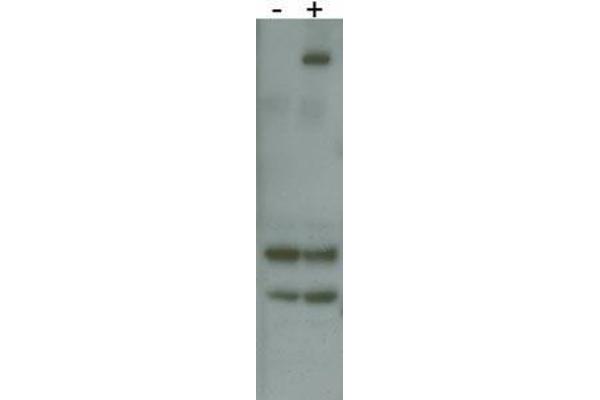 LRRK2 antibody  (AA 878-909)