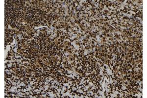 ABIN6277017 at 1/100 staining Human spleen tissue by IHC-P. (EIF5A antibody  (Internal Region))