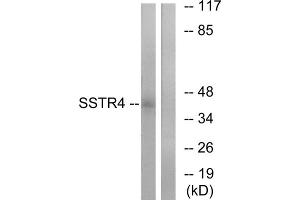 Western blot analysis of extracts from LOVO cells, using SSTR4 antibody. (SSTR4 antibody  (Internal Region))