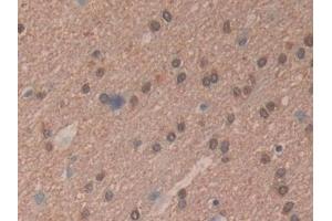 Detection of mTOR in Human Brain Tissue using Polyclonal Antibody to Serine/threonine-protein kinase mTOR (mTOR) (MTOR antibody  (AA 2226-2488))