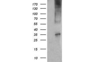 Western Blotting (WB) image for anti-T-cell surface glycoprotein CD1c (CD1C) antibody (ABIN2670660) (CD1c antibody)