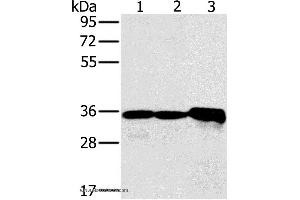 Western blot analysis of Mouse kidney tissue and Jurkat cell, mouse heart tissue, using NDUFA9 Polyclonal Antibody at dilution of 1:400