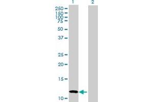 Western Blot analysis of CALCB expression in transfected 293T cell line by CALCB MaxPab polyclonal antibody. (CALCB antibody  (AA 1-127))