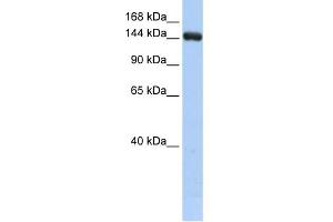 WB Suggested Anti-UGCGL2 Antibody Titration:  0. (UGCGL2 antibody  (Middle Region))