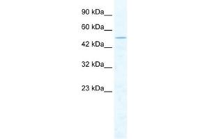 CHD1L antibody used at 2. (CHD1L antibody  (Middle Region))