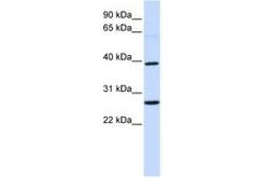 Image no. 1 for anti-Wingless-Type MMTV Integration Site Family, Member 16 (WNT16) (AA 252-301) antibody (ABIN6740724) (WNT16 antibody  (AA 252-301))